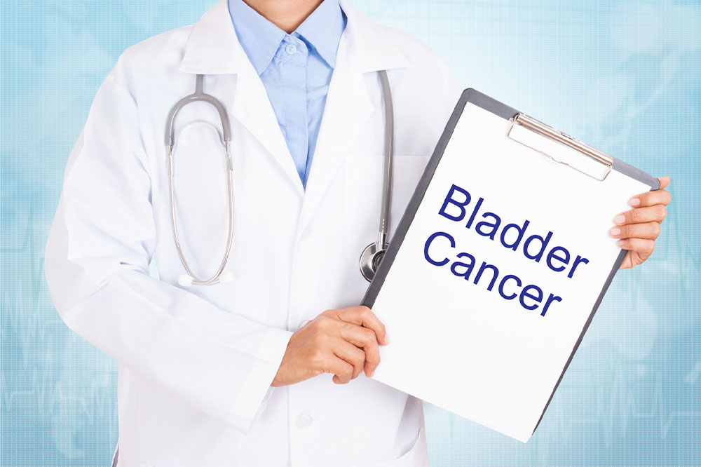 Understanding Bladder Cancer and Its Management Options