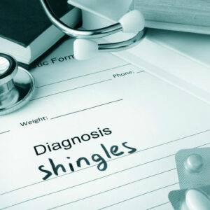 A compact guide to understanding shingles- Causes, symptoms, and treatments