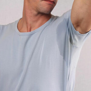 Advanced management of excessive sweating