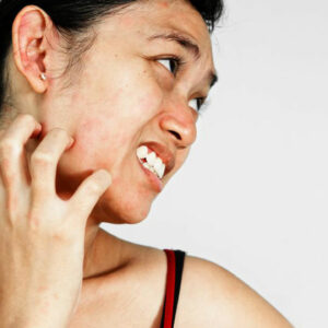 A few common types skin rash that affects people