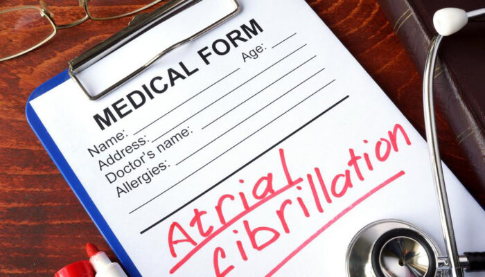 An overview of Atrial Fibrillation