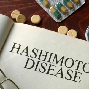 Causes and symptoms of hashimotos disease