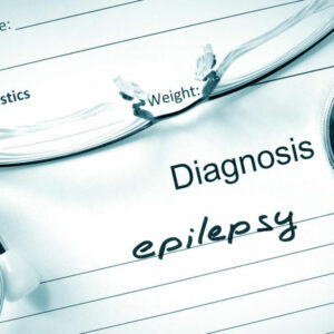 Everything you need to know about epilepsy