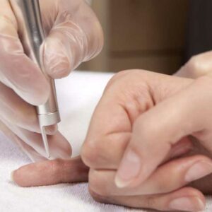 How to Get Rid of Warts Effectively