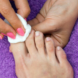 Ways to Cure Nail Fungus