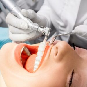 4 things you should know about good dental health