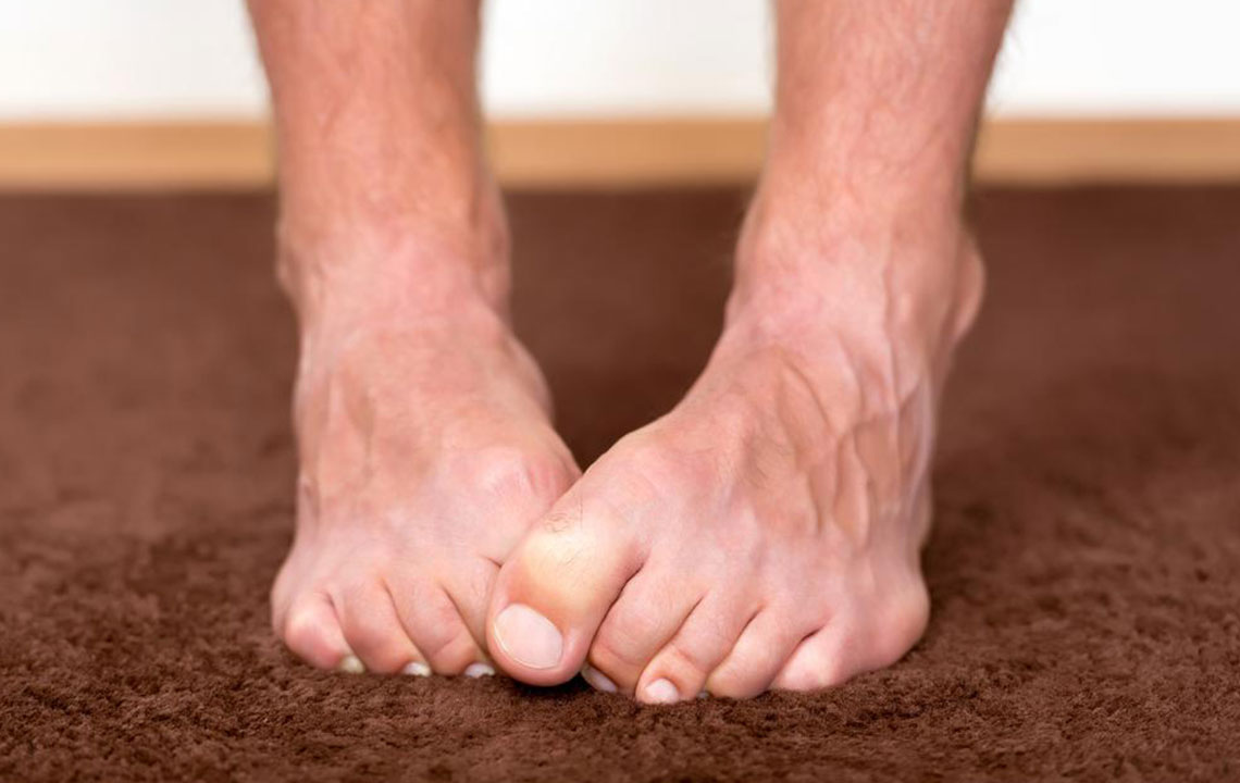 Neuropathy Foot Pain &#8211; Symptoms, Causes, Treatments and More