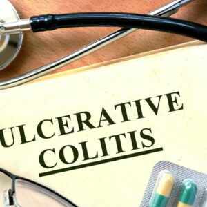 Beating Ulcerative Colitis Flares