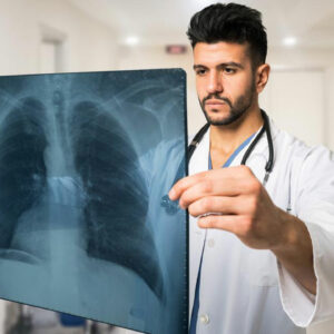 Common pulmonary embolism symptoms that you should be aware of