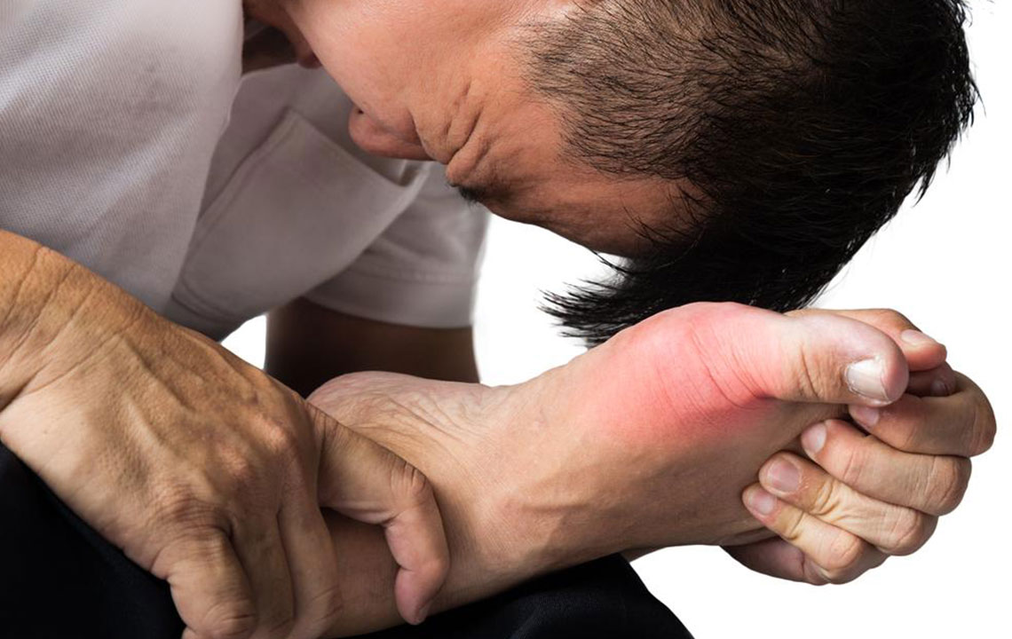 Different Treatment Plans for Gout Pain Relief and Prevention of Gout Attacks