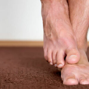 Different Ways to Deal with Neuropathy in Feet