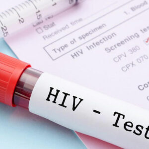 Everything you need to know about HIV and AIDS