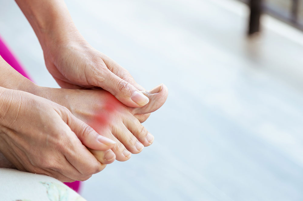 Gout &#8211; Diagnosis, stages, and prevention