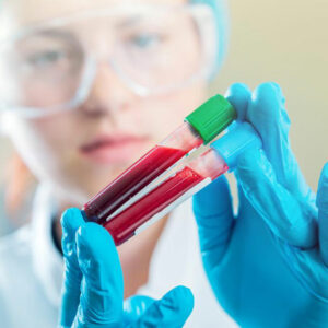 Here’s why maintaining normal creatinine levels is imperative