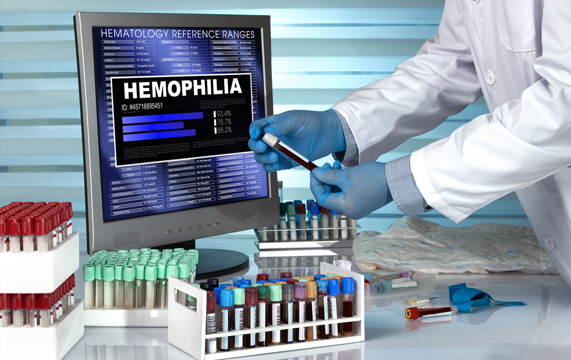 The Diagnosis and Prognosis of Hemophilia