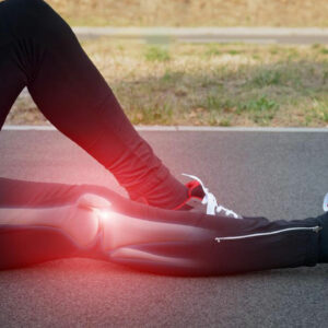 What Causes Leg Pain Behind The Knee