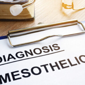 5 Treatment Options for Mesothelioma