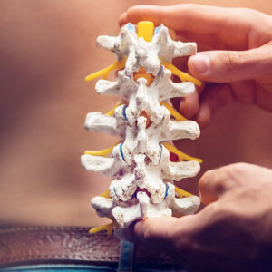 Key Things to Know About a Spine Surgeon